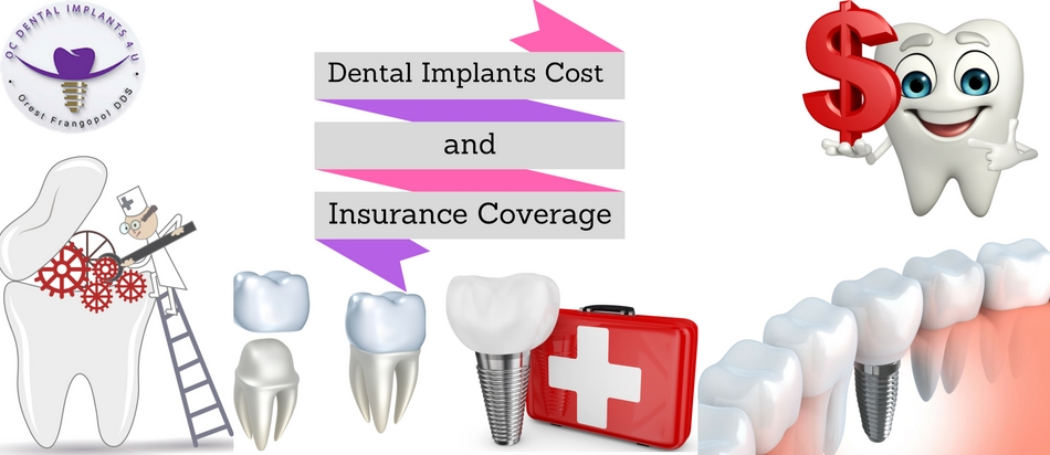 dental implant cost and financing
